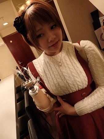 欠損アイドルの琴音さん（写真提供／ｓｇｕｔｓ氏）