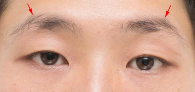  眉弓筋（矢印）のあたりには手を入れず、眉の下側をカットしよう