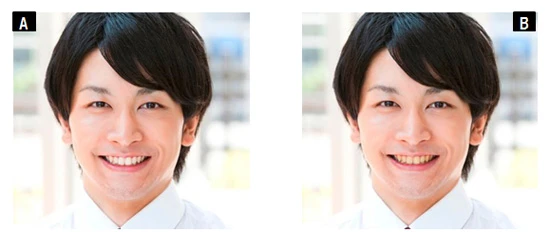歯の色の違いによって見た目年齢はどう変わる？　女性２００名に聞いたところ、（Ａ）は２８．１歳、（Ｂ）は３１．２歳と、３．１歳も差がついてしまった！