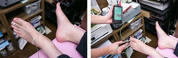 (左)レーザーを当てて足先の血流量は計測する。(右)足の表面体温の平均は26~27度。写真の後に上がり、結果30度に