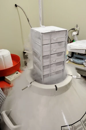 培養した肌細胞で治療に使わない分は凍結保管ができる。使う都度に初期の培養作業を行なわないことで、10年や20年後でも若い元気な細胞を使用できるスキームを確立(写真提供:株式会社セルバンク)