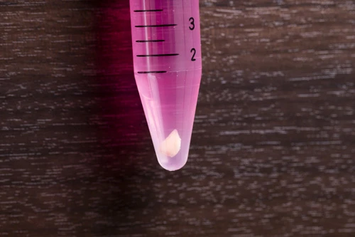 採取した皮膚。ここから肌細胞を取り出し、1万倍に増殖するのだ