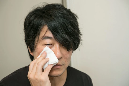 保冷剤を使って5分程度、肌細胞を移植した患部を冷やす