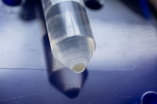 中央に薄っすらと見える肌色の物体が培養された肌細胞だ