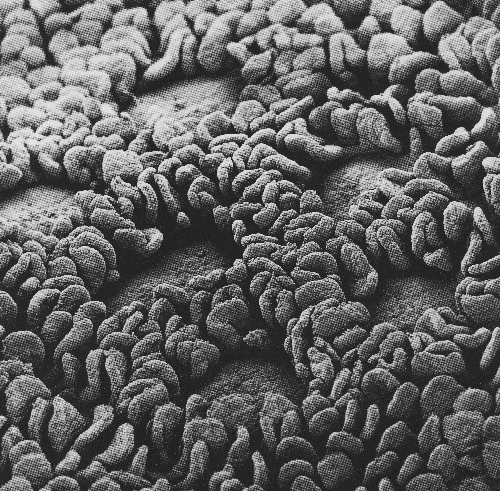 腸内細菌が髪の天敵「活性酸素」を消してくれる