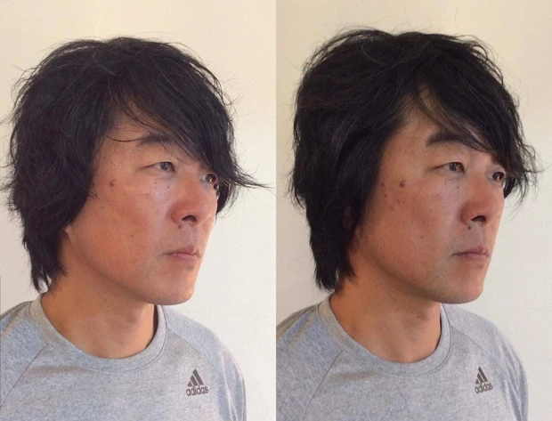 施術後は頬骨と目尻が上がっている