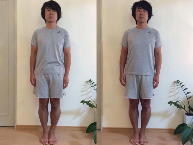 左が施術前、右が施術後。首が細長くなっている