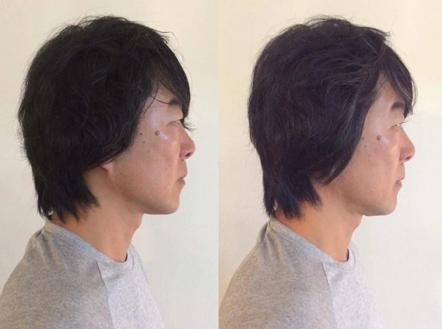 顎のラインもシャープに!