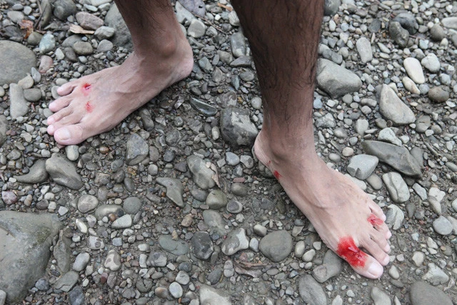 ヒルはジャングルのどこにでもいて、現地在住の石上さんも足の血を吸われていた。こうなるとしばらくの時間、血が止まらなくなる