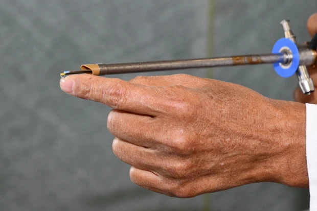 治療は服薬のほか、手術をすることもある。尿道口から細いパイプ状のカメラ付き内視鏡を挿入し、電気メスで膀胱の出口を切ったり削ったりして開きやすくする。日帰り可能で、局部麻酔使用により痛みもほとんどないという