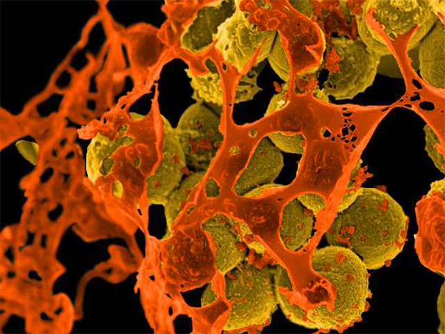 【メチシリン耐性黄色ブドウ球菌（ＭＲＳＡ）】黄色ブドウ球菌が薬剤耐性化したもの。抗菌薬の一種、メチシリンの名前についているが、実際には多種多様の抗菌薬を無力化する。そのため、ＭＲＳＡ感染症は治療が難しい死亡率の高い感染症のひとつとされ、薬剤耐性を持った黄色ブドウ球菌が心臓から血液を経由して多臓器に転移する感染性心内膜炎などの重症な感染症の原因となるほか、菌が毒素を産生することで起きる毒素性ショック症候群という致命的な病気をもたらすこともある 　©National Institute of Allergy and Infectious Diseases (NIAID).