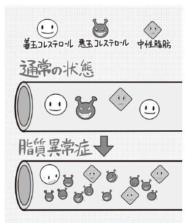 「肉食中心だと上昇する」は勘違い！ 30歳過ぎたら要注意の「中性脂肪の研究」（2021年3月12日）｜BIGLOBEニュース