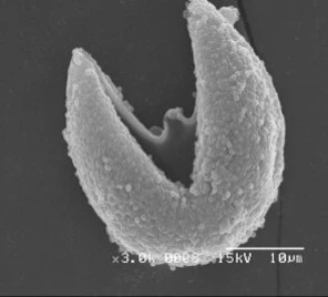 破裂した後のスギ花粉本体。破裂は大気汚染にも影響を受けて引き起こされるため、人間の活動が多い都市部のほうが起こりやすい