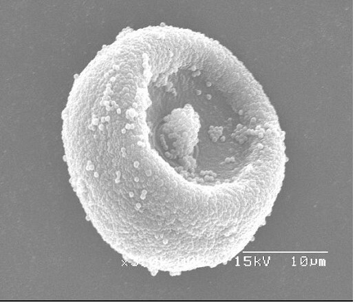 スギ花粉本体、大きさは20〜30μ程度。表面に付着している粒は表面ユービッシュ小体といい、アレルゲン物質が多く含まれている