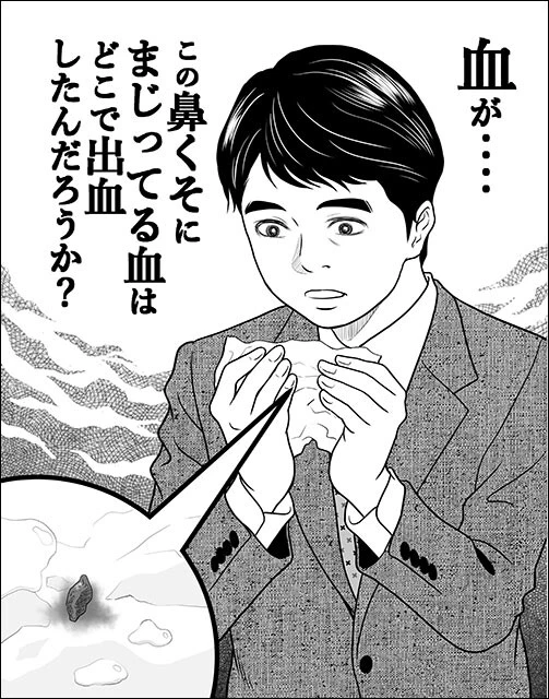 鼻の中の鼻中隔は出血しやすいので注意