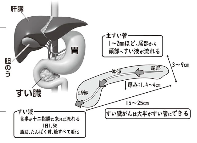 すい臓の位置は胃や肝臓の奥。高さ4㎝、長さ15㎝ほどの小さな臓器。すい液が流れる1～2㎜ほどのすい管にがんはできやすい