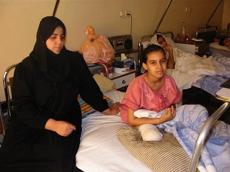 イラク。紛争に巻き込まれて片足を失った少女。(写真提供:JIM-NET)