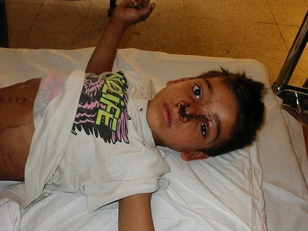 イラク。紛争に巻き込まれて放心状態の男の子。（写真提供：ＪＩＭ－ＮＥＴ）