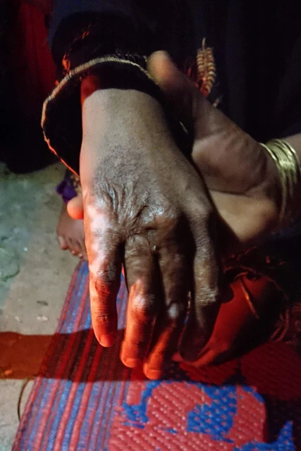 15歳の女性は手を火であぶられ、全身をナイフで傷つけられてから暴行を受けたという