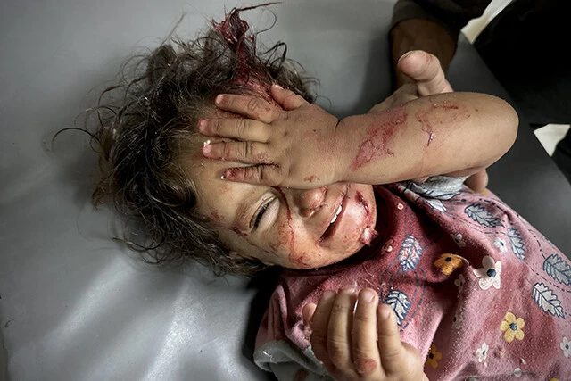 ガザでの死者の半数以上は女性や子供。写真の少女は6月10日のガザ南部ハンユニスへのイスラエル軍の攻撃によって負傷し、ナスル病院で治療を受けたが、イスラエル軍の封鎖によって医療物資は枯渇しつつある