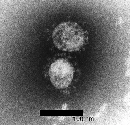 約10年前、東アジアを中心に猛威を振るったSARSコロナウイルス(西條氏提供)