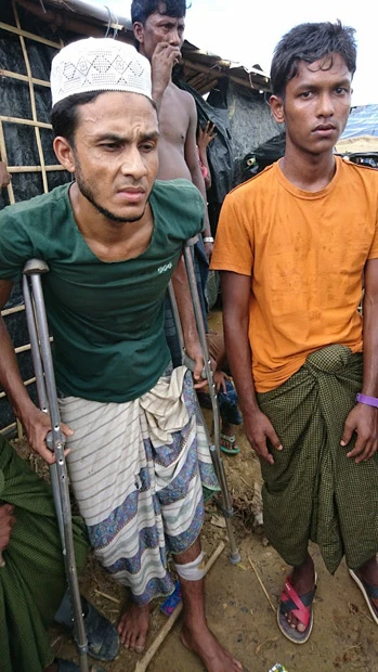 ミャンマー軍に銃撃された若者（左）。「ミサイルで家を追われ、次に機銃掃射を浴びた」。まだ体内には銃弾が残っている。