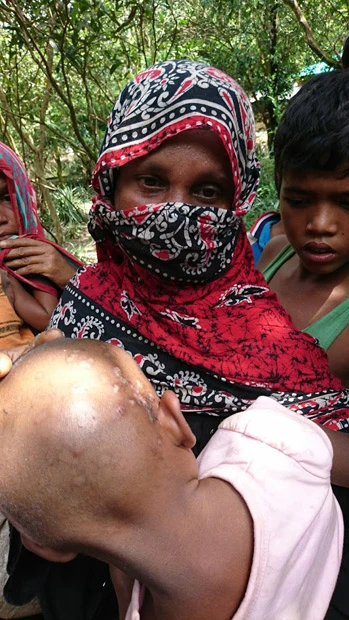 12歳の娘を目の前でレイプされ、殺害されたハミーダ。抱きかかえている2歳の女児の後頭部には腫瘍があり、ぐったりしている。