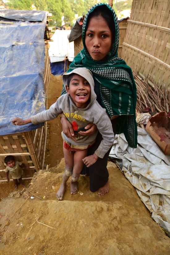 ロヒンギャの難民キャンプ（クトゥパロン）で撮影中の筆者に障がいを持つ子を抱えた女性が話しかけてきた…（続きは本文にて↓）