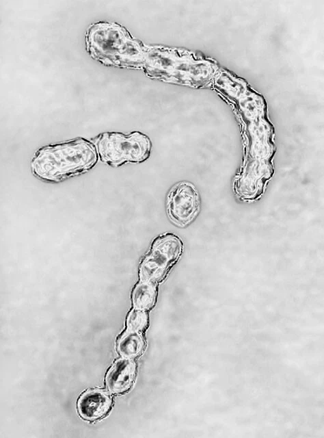 致死率3割の"劇症型感染症"はどこまで増える？ 「人食いバクテリア」の正しい怖がり方