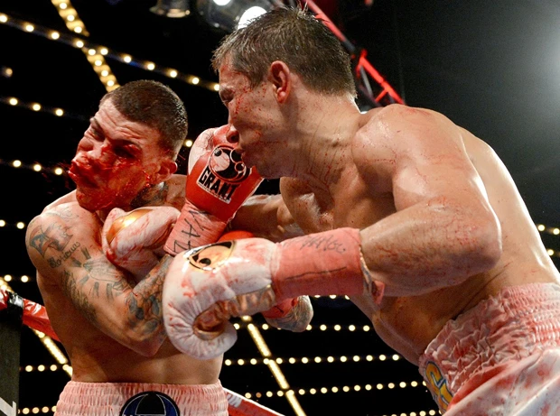 【福田氏コメント】次のスーパースター、現在最高の選手のひとりであるゴロフキンの防衛戦。この右の直後にダメージと出血のため試合がストップされました