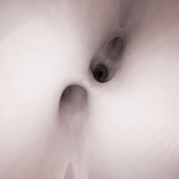 3DCGの気管支鏡検査シミュレーション。医師はこれで事前に練習できる。(C)瀬尾拡史