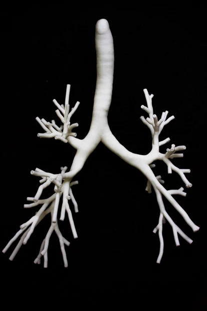 CT画像をもとに3Dプリンターで出力した瀬尾氏の3D気管支模型。気管支鏡を入れて練習できるよう、内部の太さは実物と同じになっている。