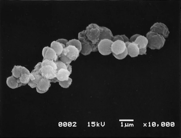 宇宙空間で紫外線を耐えた微生物(デイノコッカス・ラジオデュランス)